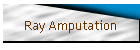 Ray Amputation