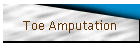 Toe Amputation