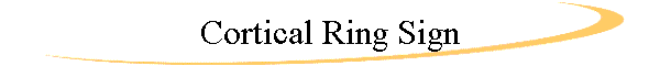 Cortical Ring Sign